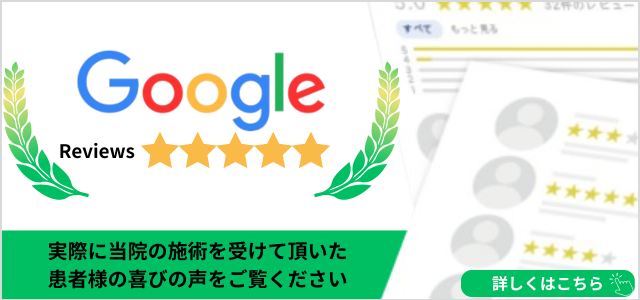 Googleレビュー