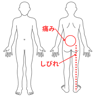 症状画像